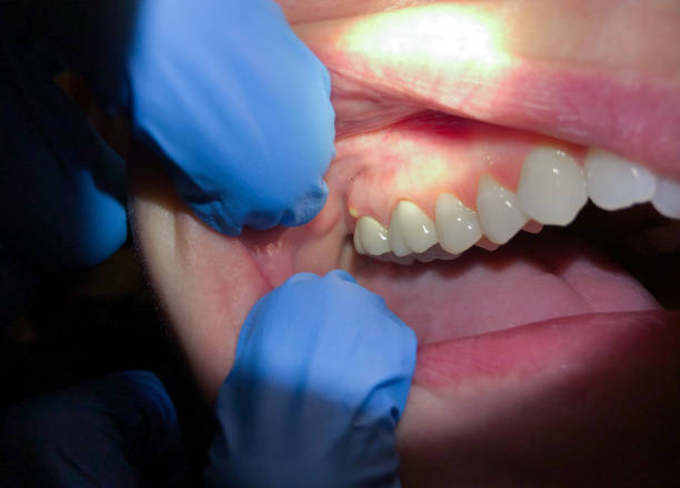 Best Emergency Dentist for Special Needs Patients in El Paso, IL