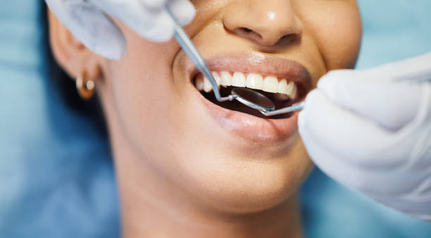 Best Emergency Dental Care for Abscessed Tooth in El Paso, IL