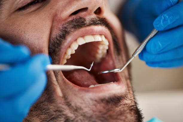 Best Emergency Dentist for Special Needs Patients in El Paso, IL